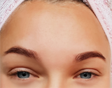 Before and after comparison of a person's eye area with and without treatment.